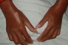 精液異常有哪些發(fā)病因素