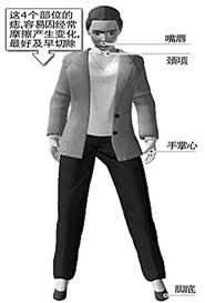 附睪炎患者的飲食注意事項