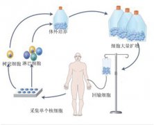 DC-CIK療法臨床治療過程